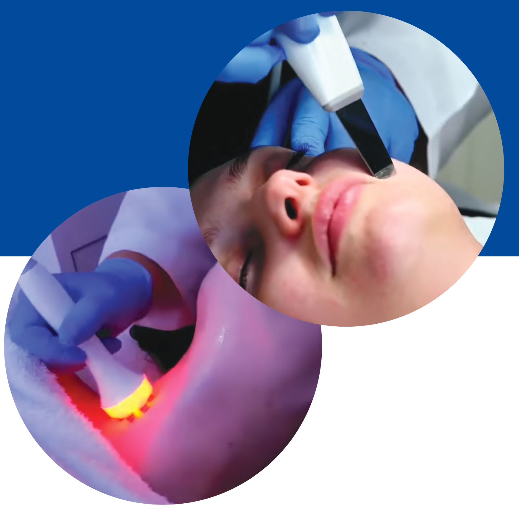 Ultrasonic spatula and LED light therapy